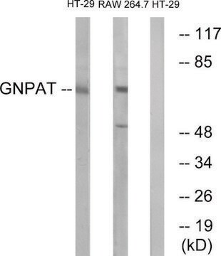 Anti-GNPAT antibody produced in rabbit affinity isolated antibody