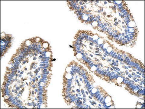 Anti-FZD9 antibody produced in rabbit IgG fraction of antiserum