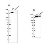 Anti-FASN antibody produced in rabbit Prestige Antibodies&#174; Powered by Atlas Antibodies, affinity isolated antibody, buffered aqueous glycerol solution