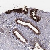 Anti-TGM4 antibody produced in rabbit Prestige Antibodies&#174; Powered by Atlas Antibodies, affinity isolated antibody, buffered aqueous glycerol solution