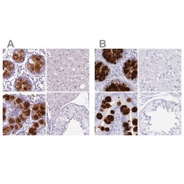 Anti-CLCA1 antibody produced in rabbit Prestige Antibodies&#174; Powered by Atlas Antibodies, affinity isolated antibody, buffered aqueous glycerol solution