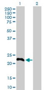 Anti-TSC22D3 antibody produced in rabbit purified immunoglobulin, buffered aqueous solution