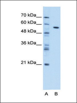 Anti-CES1 (AB1) antibody produced in rabbit IgG fraction of antiserum