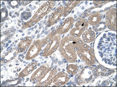 Anti-CDH8 antibody produced in rabbit affinity isolated antibody