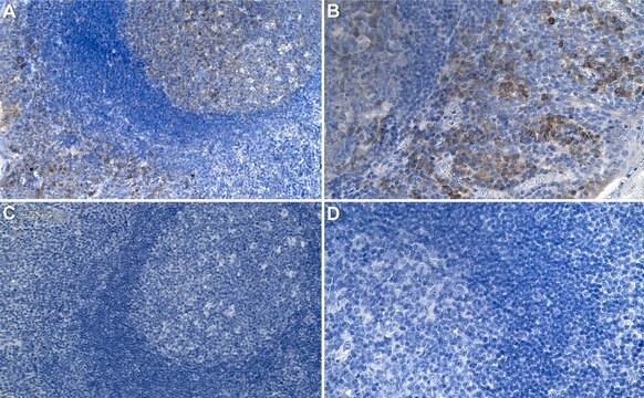 Anti-IL-8 Antibody, clone 1D20 ZooMAb&#174; Rabbit Monoclonal recombinant, expressed in HEK 293 cells