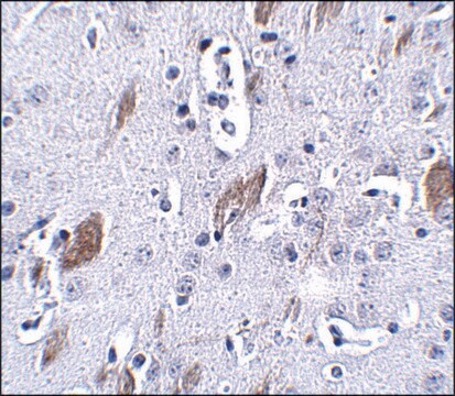 Anti-ATOH8 antibody produced in rabbit affinity isolated antibody, buffered aqueous solution