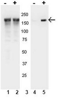 Anti-phospho-EGFR (Tyr1148) Antibody Upstate&#174;, from rabbit