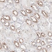 Anti-KCNJ1 antibody produced in rabbit Prestige Antibodies&#174; Powered by Atlas Antibodies, affinity isolated antibody, buffered aqueous glycerol solution