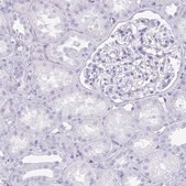 Anti-TNNT1 antibody produced in rabbit Prestige Antibodies&#174; Powered by Atlas Antibodies, affinity isolated antibody, buffered aqueous glycerol solution
