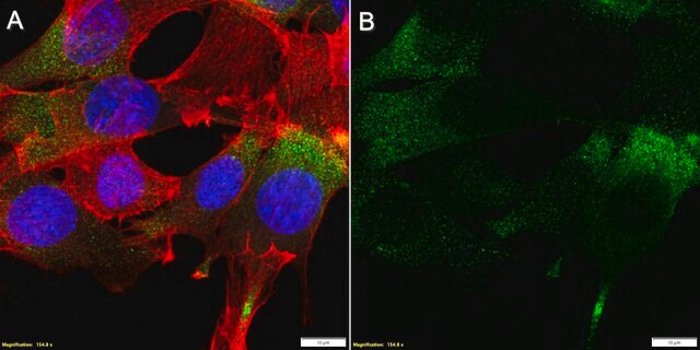 Anti-CHRNA1/ACHRA Antibody, clone 2G22 ZooMAb&#174; Rabbit Monoclonal recombinant, expressed in HEK 293 cells