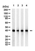 Anti-PKA C-&#945; Antibody, clone 2E17 ZooMAb&#174; Rabbit Monoclonal recombinant, expressed in HEK 293 cells