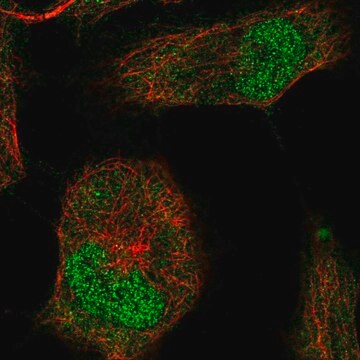 Anti-T antibody produced in rabbit affinity isolated antibody, buffered aqueous glycerol solution