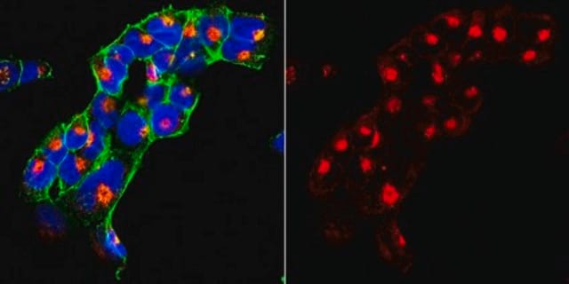 Anti-SorLA Antibody, clone 20C11 clone 20C11, from mouse