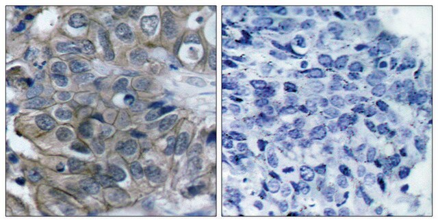 Anti-HER2 antibody produced in rabbit affinity isolated antibody