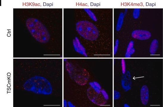 ChIPAb+ Trimethyl-Histone H3 (Lys4) - ChIP Validated Antibody and Primer Set, rabbit monoclonal from rabbit