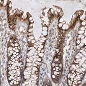 Anti-MXI1 antibody produced in rabbit Prestige Antibodies&#174; Powered by Atlas Antibodies, affinity isolated antibody, buffered aqueous glycerol solution