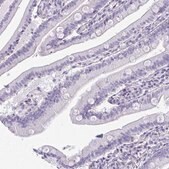 Anti-FABP3 antibody produced in rabbit Prestige Antibodies&#174; Powered by Atlas Antibodies, affinity isolated antibody, buffered aqueous glycerol solution