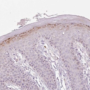 Anti-ZNF814 antibody produced in rabbit Prestige Antibodies&#174; Powered by Atlas Antibodies, affinity isolated antibody, buffered aqueous glycerol solution