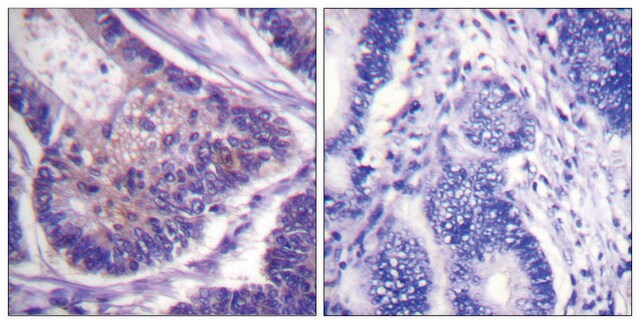 Anti-EIF4B antibody produced in rabbit affinity isolated antibody