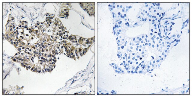 Anti-RSAD1 antibody produced in rabbit affinity isolated antibody