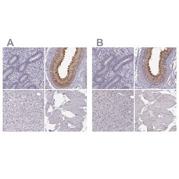 Anti-ADGRG2 antibody produced in rabbit Prestige Antibodies&#174; Powered by Atlas Antibodies, affinity isolated antibody