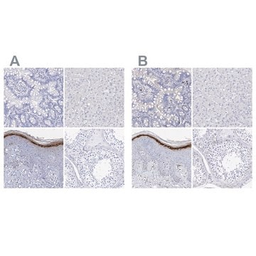 Anti-FLG antibody produced in rabbit Prestige Antibodies&#174; Powered by Atlas Antibodies, affinity isolated antibody, buffered aqueous glycerol solution, ab3