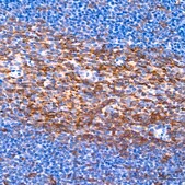 Anti-Muscarinic AChR M2 (ACM2) Antibody, clone 3T5W8, Rabbit Monoclonal