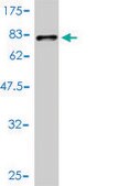 Monoclonal Anti-TUBA6 antibody produced in mouse clone 1D2-H5, purified immunoglobulin, buffered aqueous solution