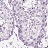 Anti-LGSN antibody produced in rabbit Prestige Antibodies&#174; Powered by Atlas Antibodies, affinity isolated antibody