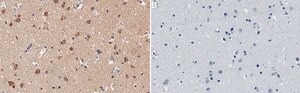 Anti-ROCK2 Antibody, clone 1B20 ZooMAb&#174; Rabbit Monoclonal recombinant, expressed in HEK 293 cells