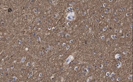 Anti-&#946;-Tubulin III Antibody, clone 5H16, ZooMAb&#174; Rabbit Monoclonal recombinant, expressed in HEK 293 cells