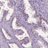 Anti-SLC35C1 antibody produced in rabbit Prestige Antibodies&#174; Powered by Atlas Antibodies, affinity isolated antibody, buffered aqueous glycerol solution