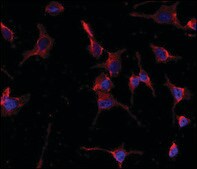 Anti-CYP26A1 (center) antibody produced in rabbit saturated ammonium sulfate (SAS) precipitated, buffered aqueous solution