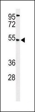 ANTI-CBAA1 (N-TERM) antibody produced in rabbit IgG fraction of antiserum, buffered aqueous solution