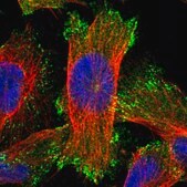 Anti-ERC1 antibody produced in rabbit Prestige Antibodies&#174; Powered by Atlas Antibodies, affinity isolated antibody, buffered aqueous glycerol solution, Ab1