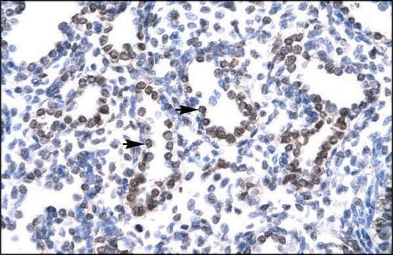 Anti-HEY1 antibody produced in rabbit IgG fraction of antiserum