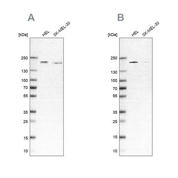 Anti-SMARCC2 antibody produced in rabbit affinity isolated antibody, buffered aqueous glycerol solution