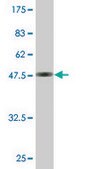 Monoclonal Anti-TAGLN antibody produced in mouse clone 1D11, purified immunoglobulin, buffered aqueous solution