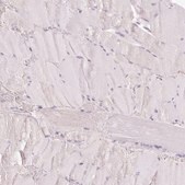 Anti-CYP11B2 antibody produced in rabbit Prestige Antibodies&#174; Powered by Atlas Antibodies, affinity isolated antibody, buffered aqueous glycerol solution