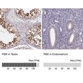 Anti-PBK antibody produced in rabbit Prestige Antibodies&#174; Powered by Atlas Antibodies, affinity isolated antibody