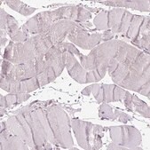 Anti-GLB1 antibody produced in rabbit Prestige Antibodies&#174; Powered by Atlas Antibodies, affinity isolated antibody, buffered aqueous glycerol solution