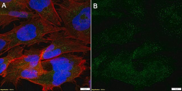 Anti-METTL4 Antibody, clone 2I6 ZooMAb&#174; Rabbit Monoclonal recombinant, expressed in HEK 293 cells