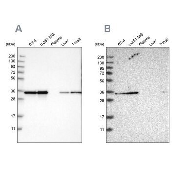 Anti-PPA1 antibody produced in rabbit Prestige Antibodies&#174; Powered by Atlas Antibodies, affinity isolated antibody, buffered aqueous glycerol solution, Ab1