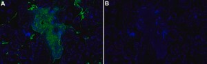 Anti-Fibrin Antibody, clone 59D8 ZooMAb&#174; Mouse Monoclonal recombinant, expressed in HEK 293 cells