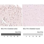 Monoclonal Anti-Bcl11A Antibody Produced In Mouse Prestige Antibodies&#174; Powered by Atlas Antibodies, clone CL13530, affinity isolated antibody, buffered aqueous glycerol solution