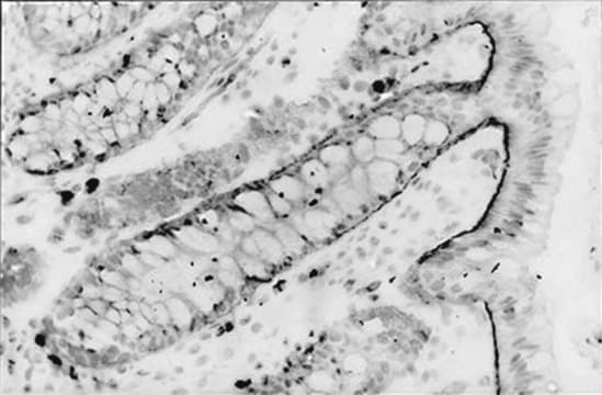 Anti-Integrin &#945;6 Antibody, clone NKI-GoH3 clone NKI-GoH3, Chemicon&#174;, from rat