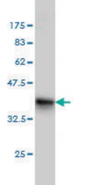 ANTI-FHIT antibody produced in mouse clone 3A5, purified immunoglobulin, buffered aqueous solution