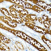 Anti-Caspase 1 antibody produced in rabbit