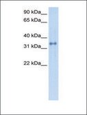 Anti-CA4 (AB1) antibody produced in rabbit affinity isolated antibody