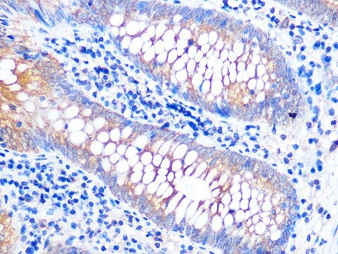 Anti-VAMP8 Antibody, clone 5H9S4, Rabbit Monoclonal